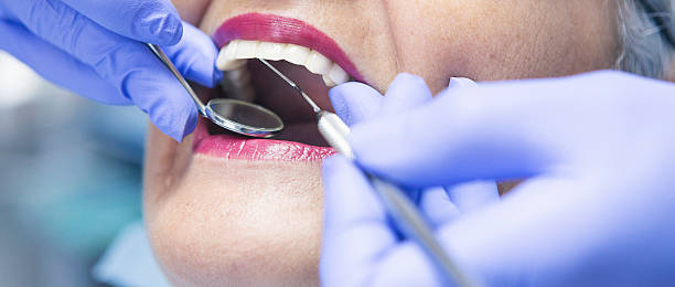 Best Emergency Tooth Extraction in Cottage City, MD